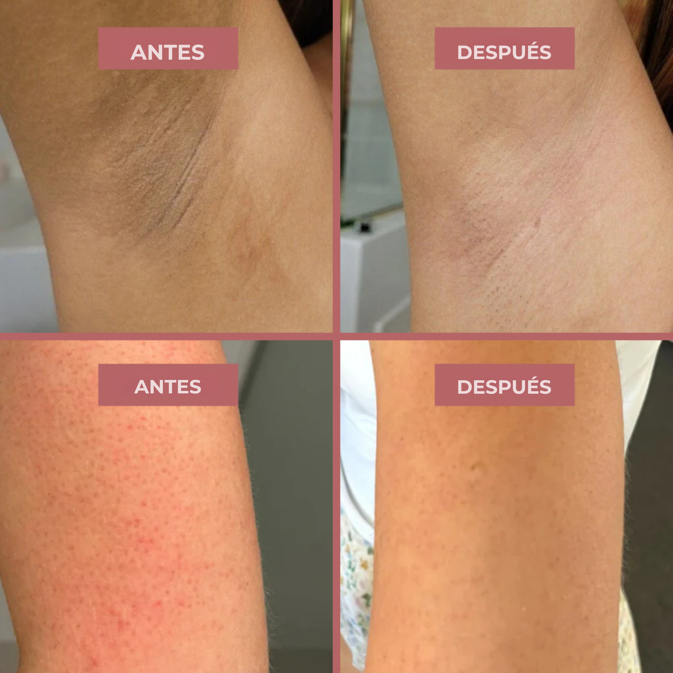 Guida illustrata all'uso dello spray esfoliante corpo SaffraSkin