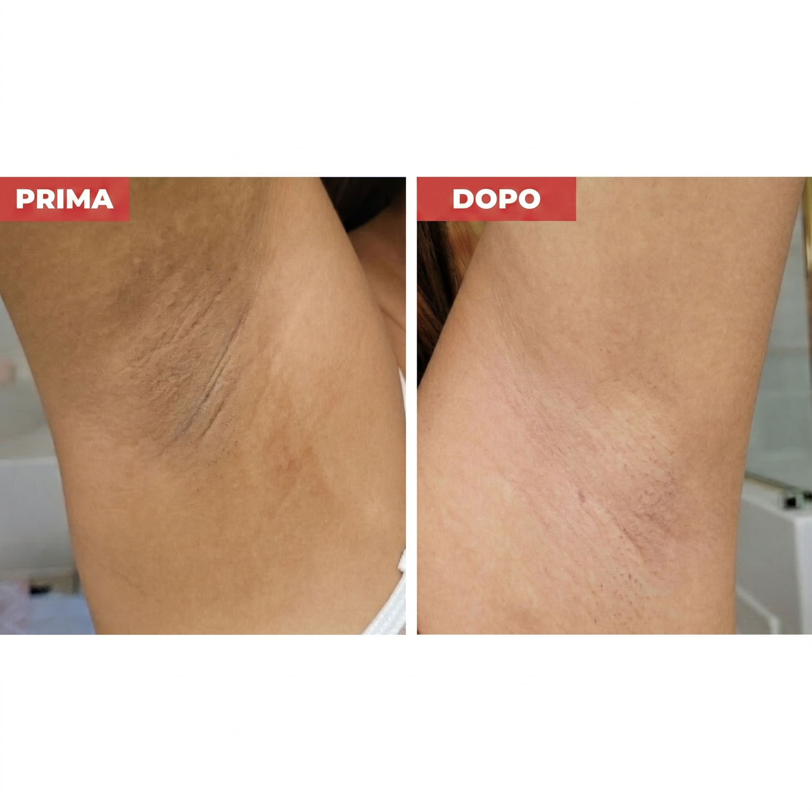Prima e dopo: Piedi di seta in pochi minuti 👣