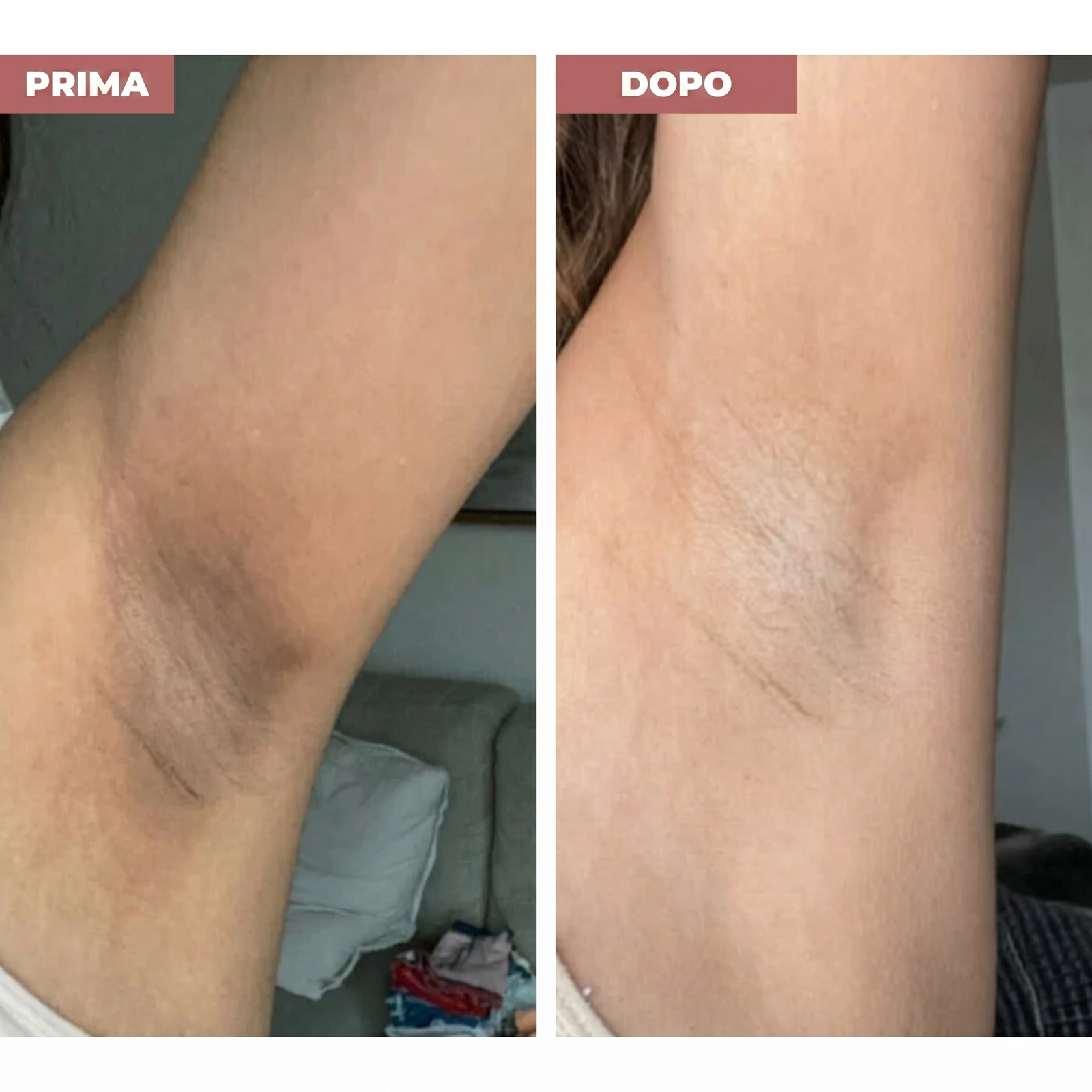 Prima e dopo: Fiducia totale in pochi secondi 🙌