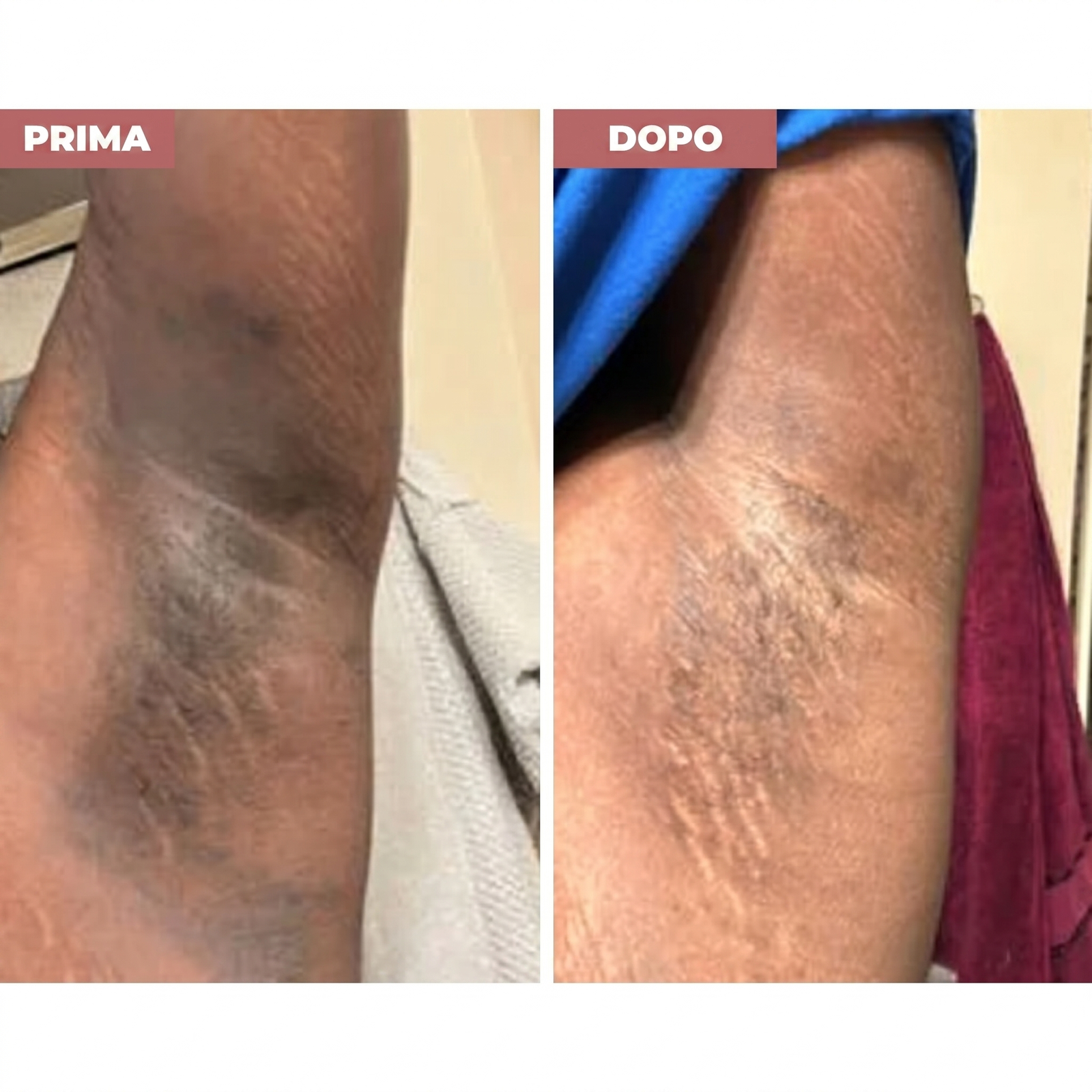 Prima e dopo: Texture e tono ritrovati ✨